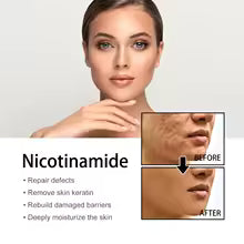 Serum facial con nicotinamida para cuidado de la piel